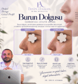 Dr. Ersin Ataman burun dolgusu öncesi ve sonrası doğal profil dengesi görseli