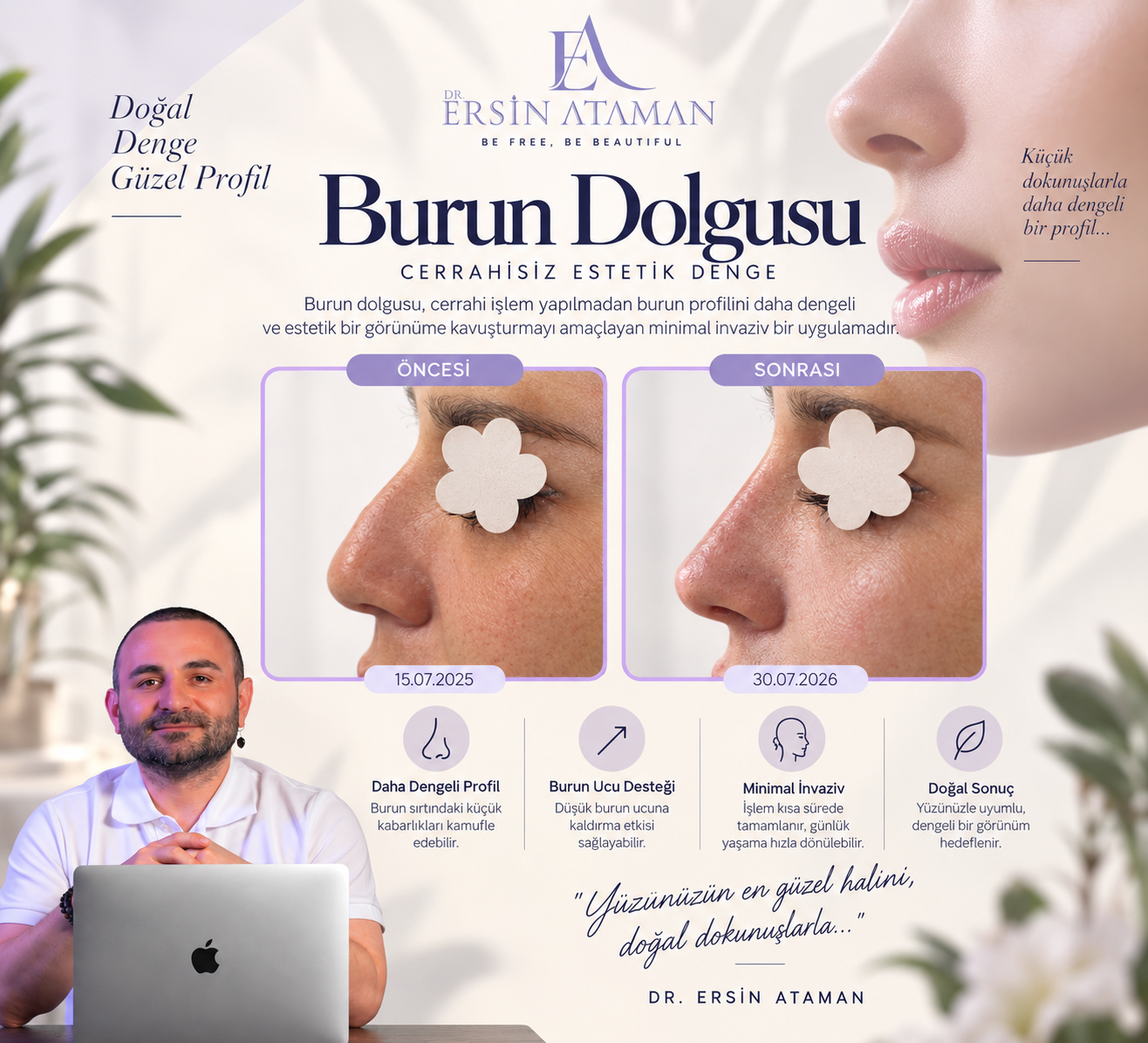 Dr. Ersin Ataman burun dolgusu öncesi ve sonrası doğal profil dengesi görseli
